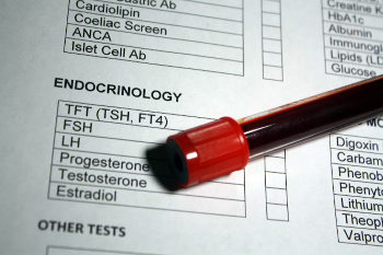 Testosterone Therapy Guidelines From the Endocrine Society